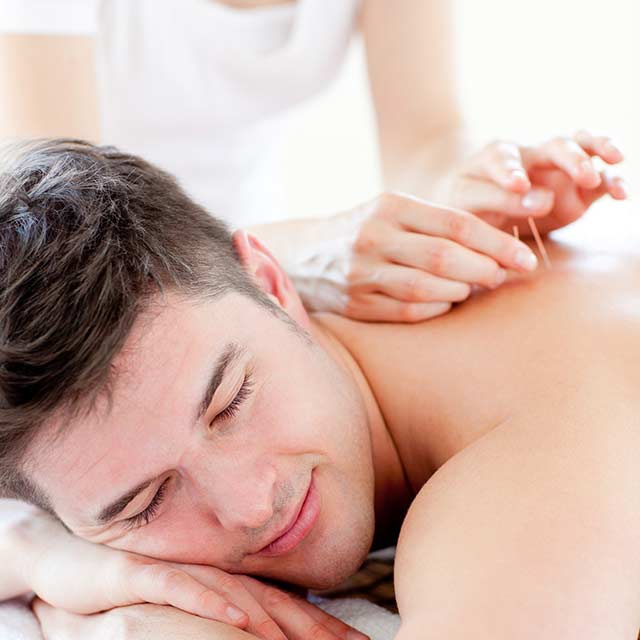 Provitaal-fysiotherapie-meeden-dry-needling_fysiotherapie_SQ-02 man krijgt dry needling in de bovenrug