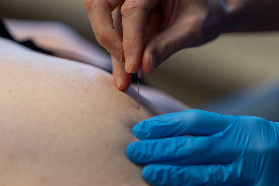 Dry-needling_ProVitaal-Meeden_CT-01