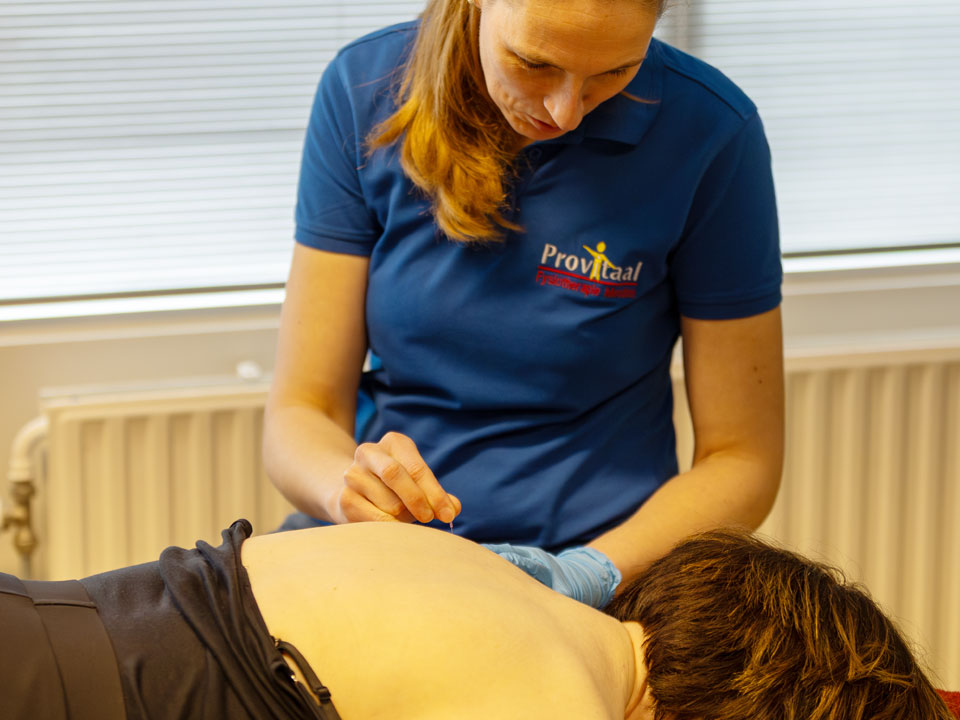 dry-needling-new_CT-01_Provotaal-Meeden