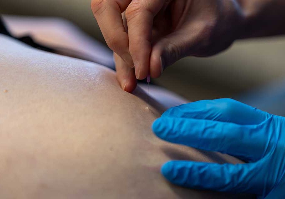 Dry-needling_ProVitaal-Meeden_CT-02