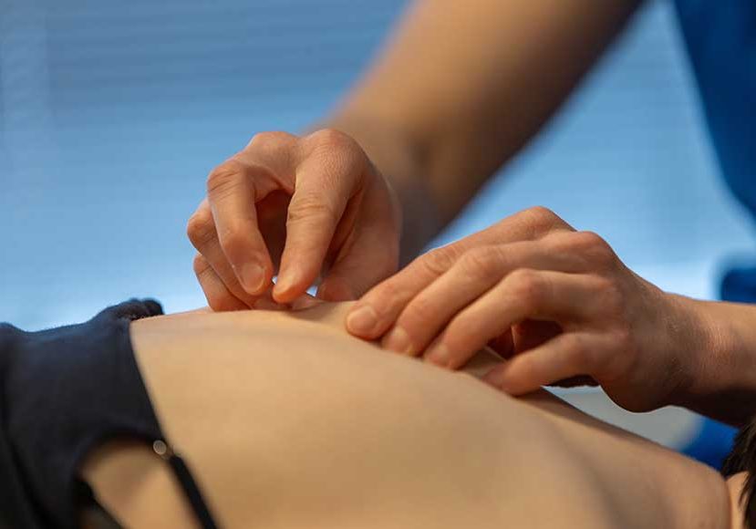 Dry-needling_ProVitaal-Meeden_CT-11 Dry-needling_ProVitaal-Meeden_CT-11